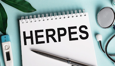 not disclosing hsv-1